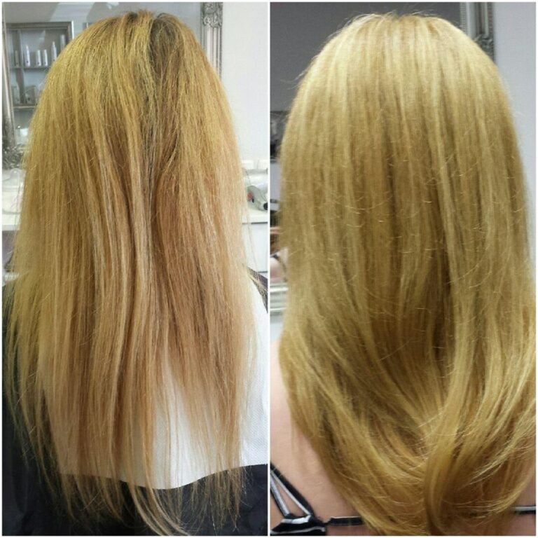 Revolucionarna metoda naravne obnove las s trajnim učinkom LITERAM 17 prej potem izjava 2